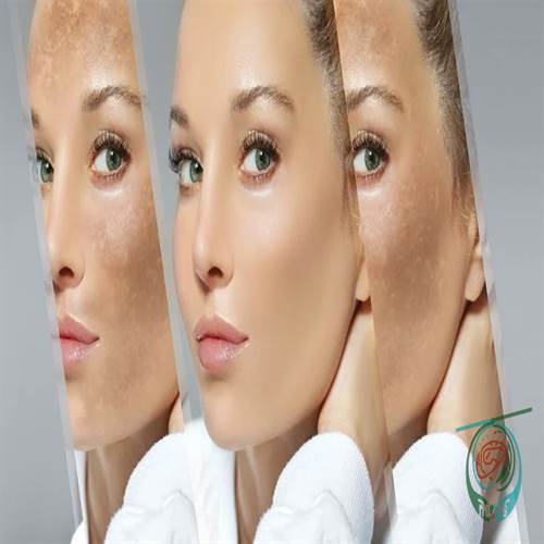 تولید محتوای ویدئویی و تصویری برای جذب مشتریان کلینیک زیبایی تولید محتوای ویدئویی و تصویری برای جذب مشتریان کلینیک زیبایی
